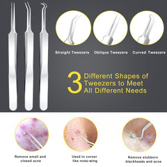 Boxoyx pimple popper tool kit for nose use highlights targeted blemish removal.