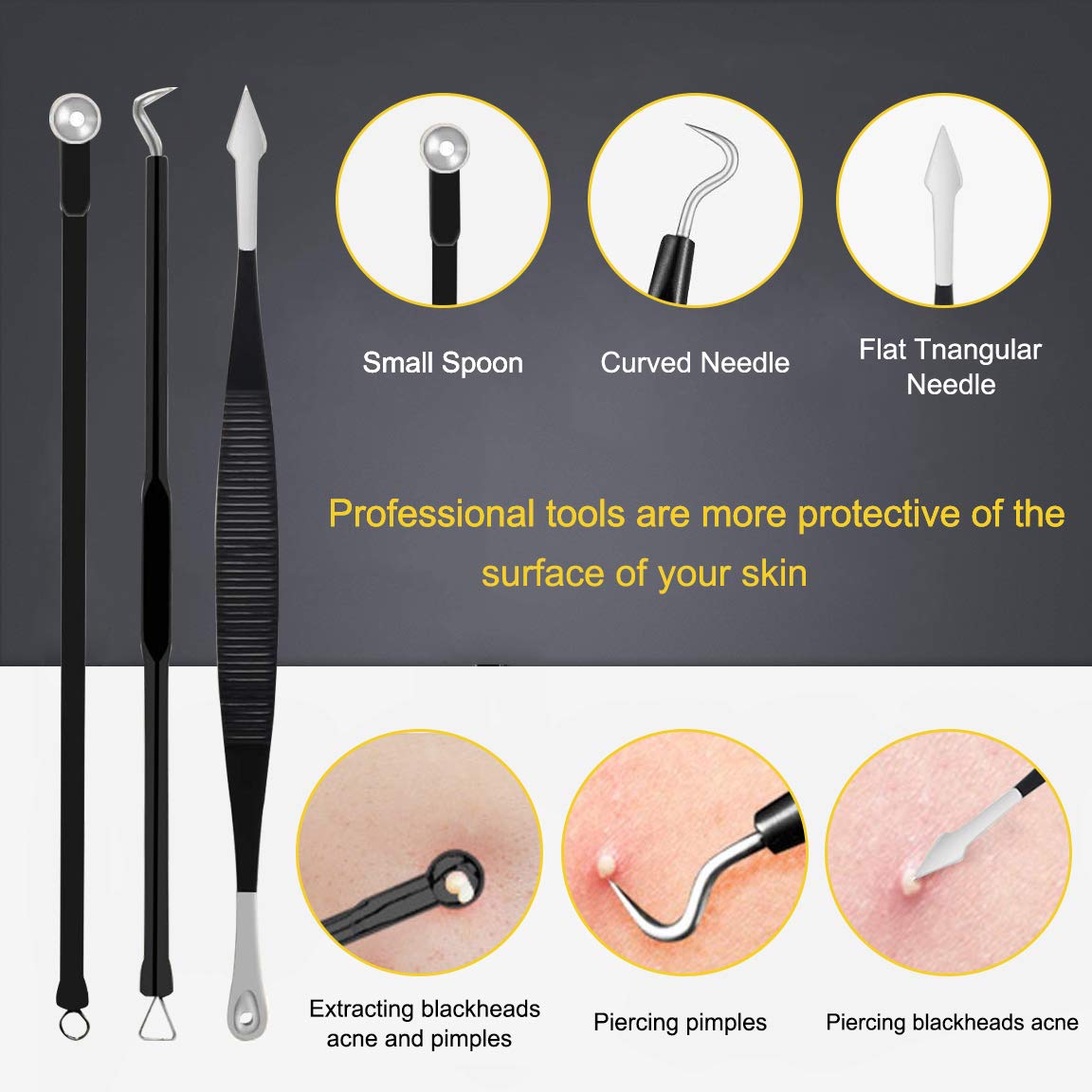 Boxoyx stainless steel pimple extractor tips offer rust-resistant reliability and safety