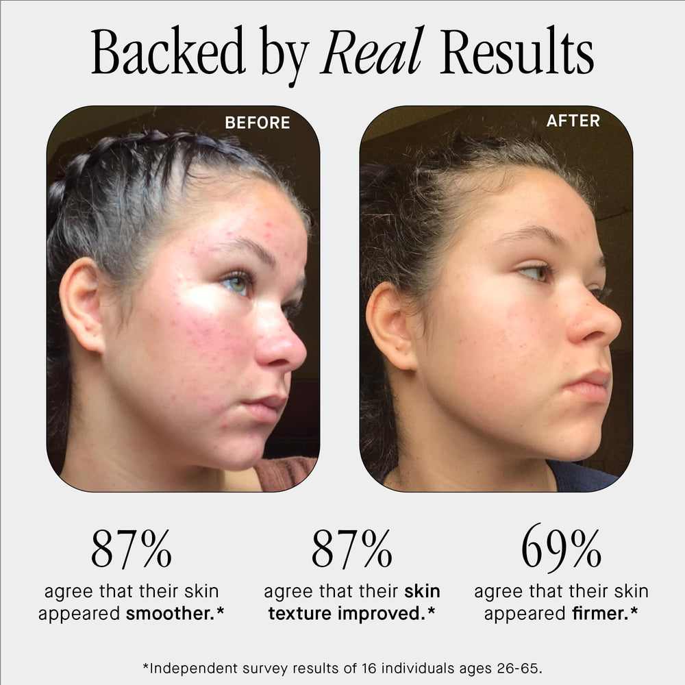 Brandefy No Needles serum pump being pressed during morning routine for quick hydration.