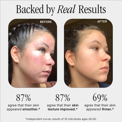 Brandefy No Needles serum pump being pressed during morning routine for quick hydration.