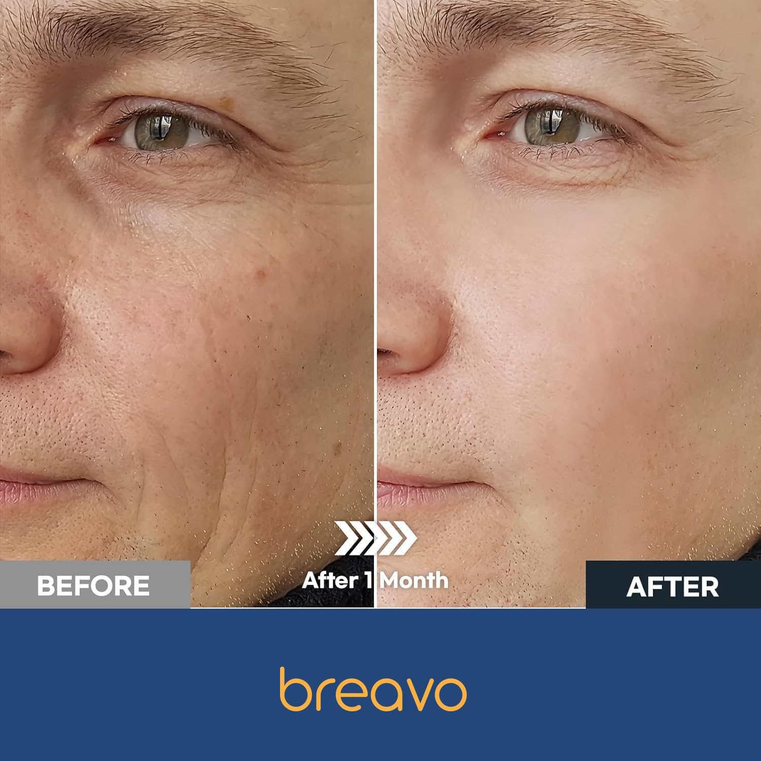 Breavo 6-in-1 face cream wrinkle closeup shows subtle aging reduction