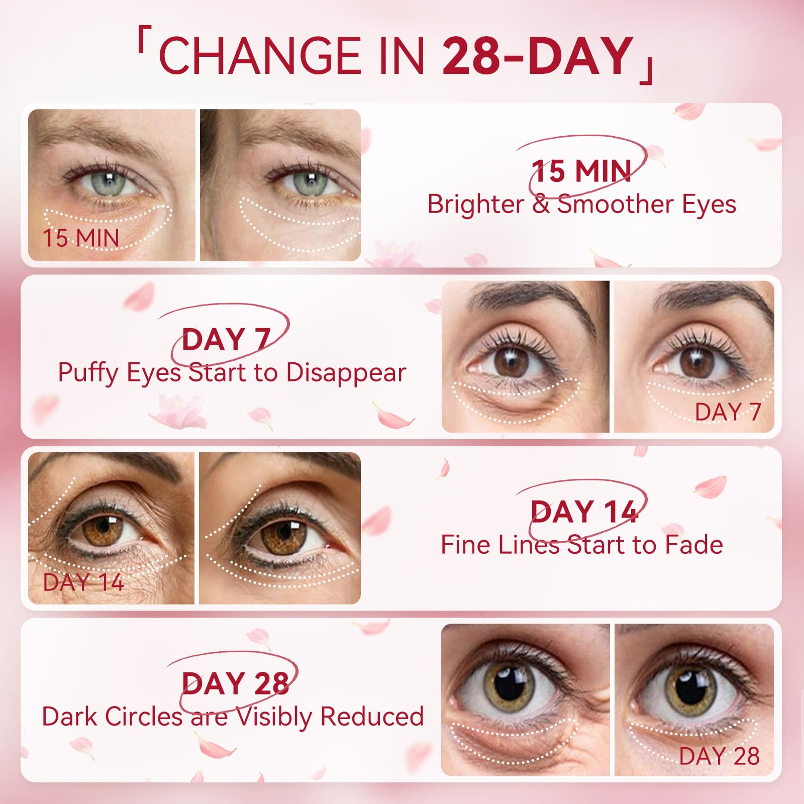 BREYLEE Rose Eye Patch grid design visible for hands-free wear