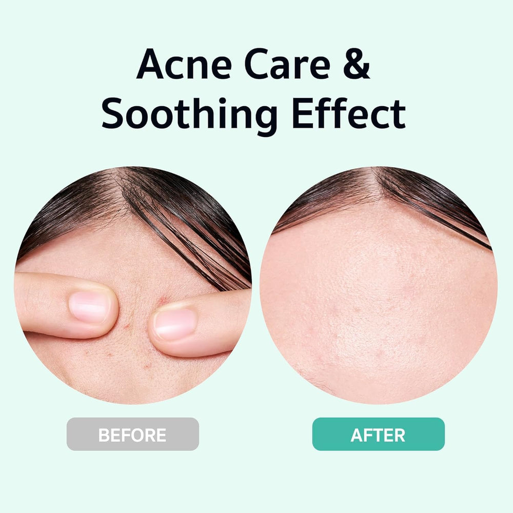 BRING GREEN squid game edition serum pump enables easy, controlled application for balanced skin.