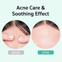 BRING GREEN squid game edition serum pump enables easy, controlled application for balanced skin.