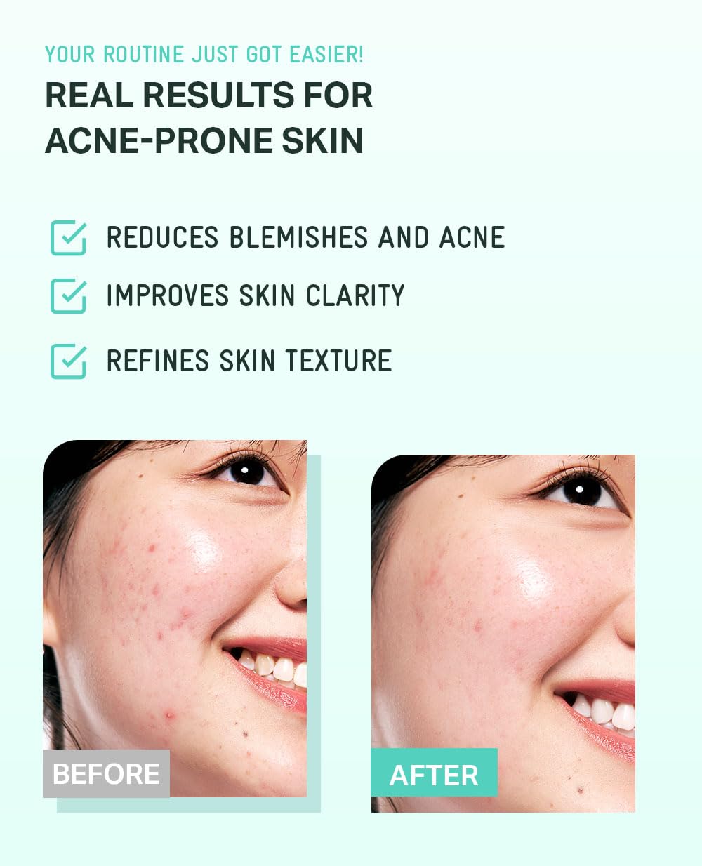 BRING GREEN Tea Tree Cica Cream being applied to the face.
