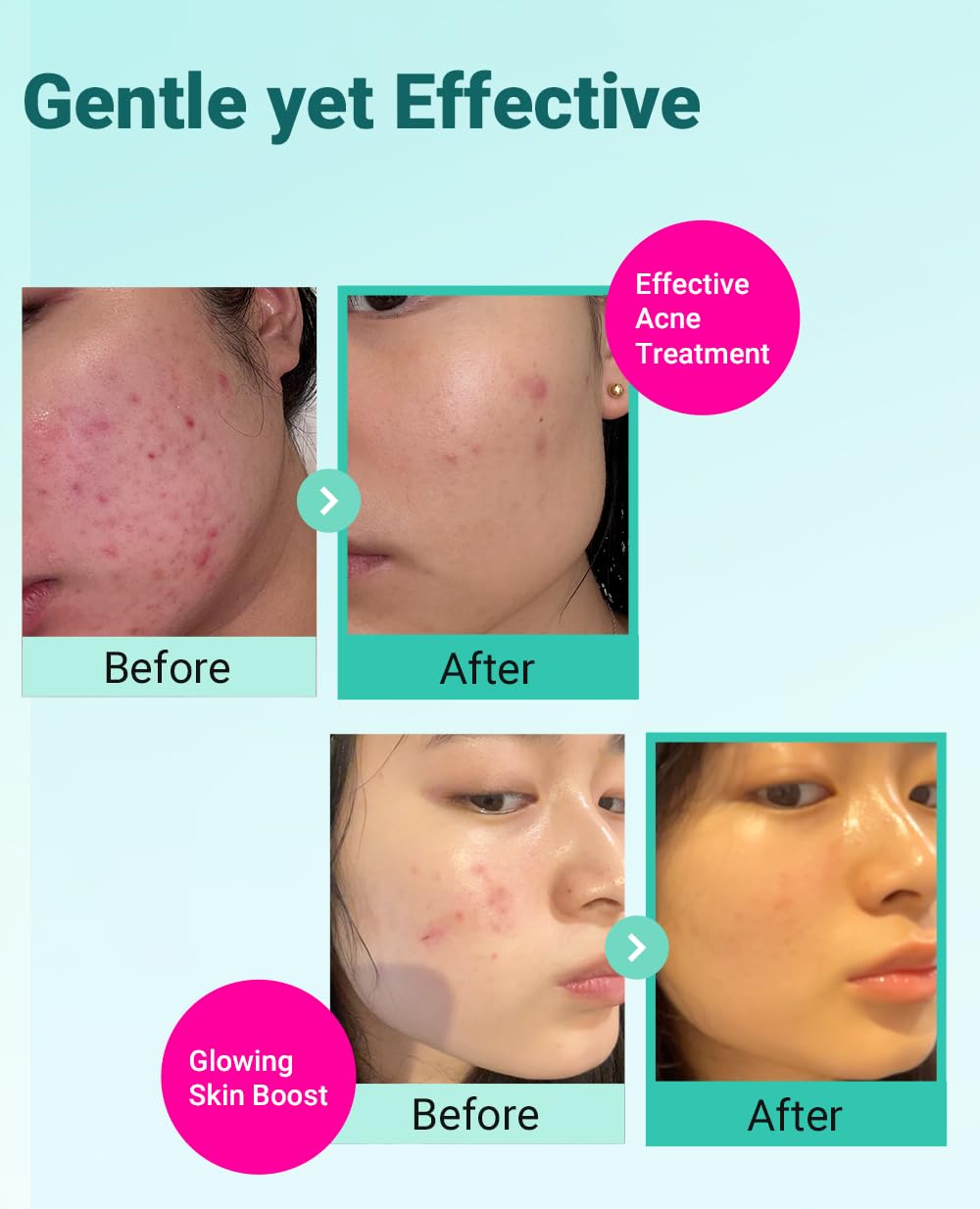 BRING GREEN Zinc Teca Serum close-up shows lightweight blemish targeted formula