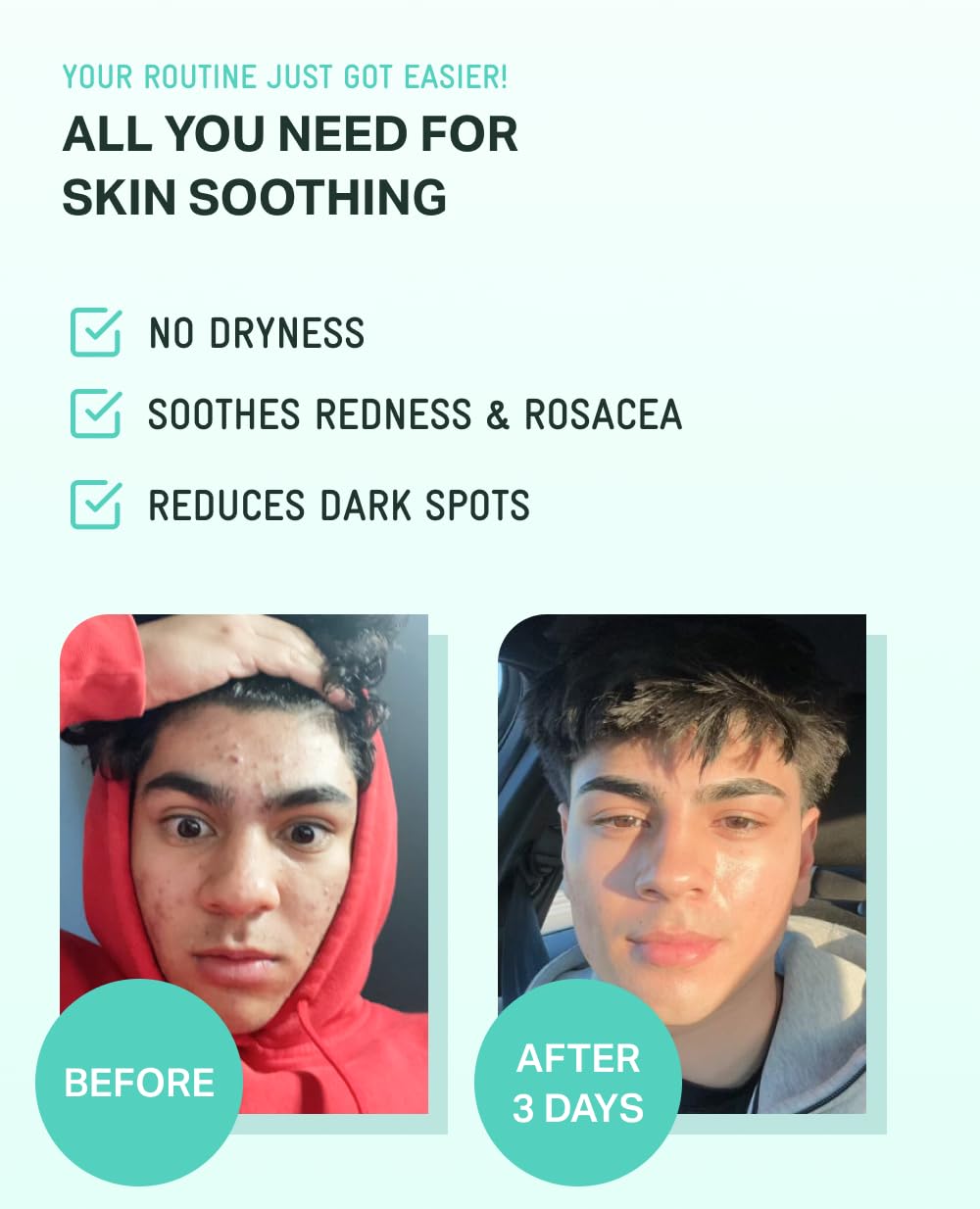 BRING GREEN Zinc Teca Serum on face suggesting calming, even-toned skin potential.