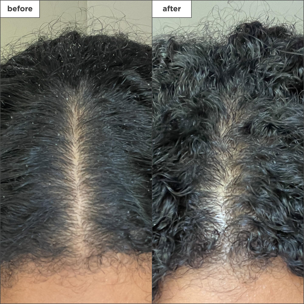 Briogeo Scalp Revival binchotan charcoal absorption highlights impurity detox