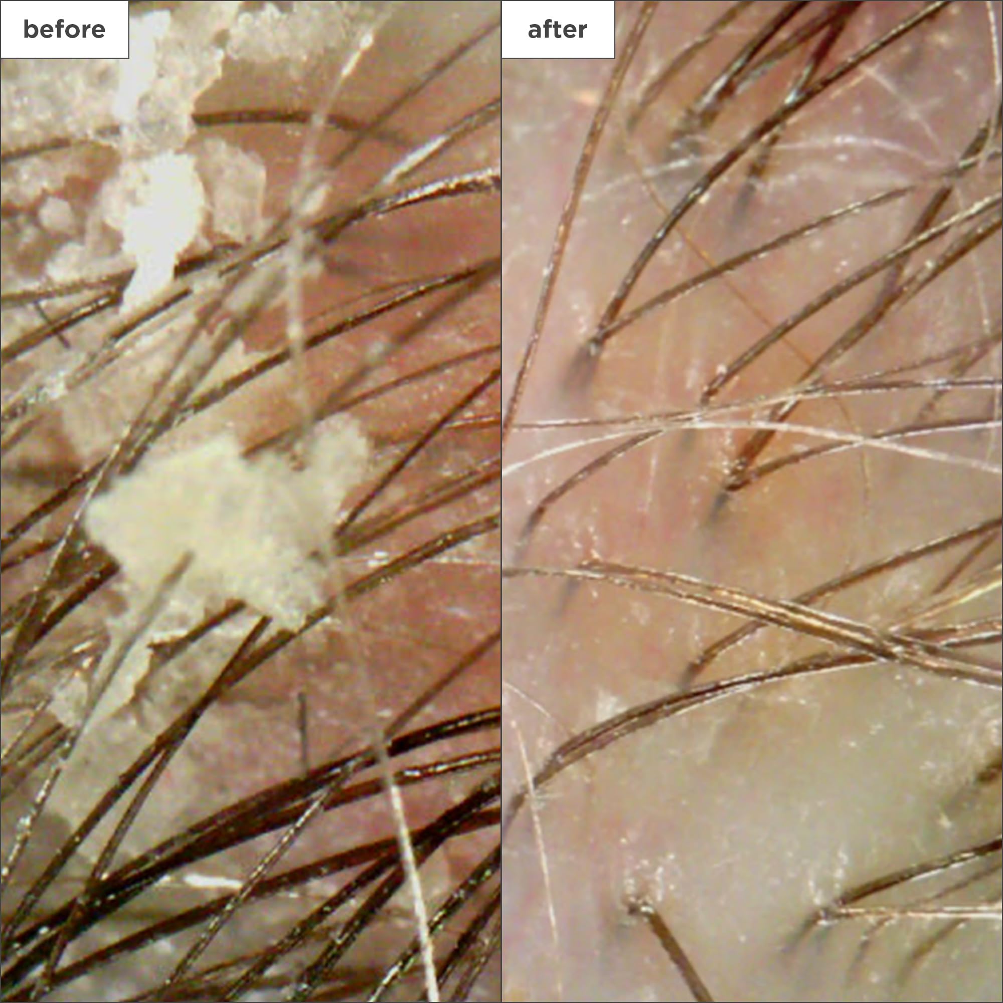 Briogeo Scalp Revival: gota de bisabolol en la fórmula, calma irritación.