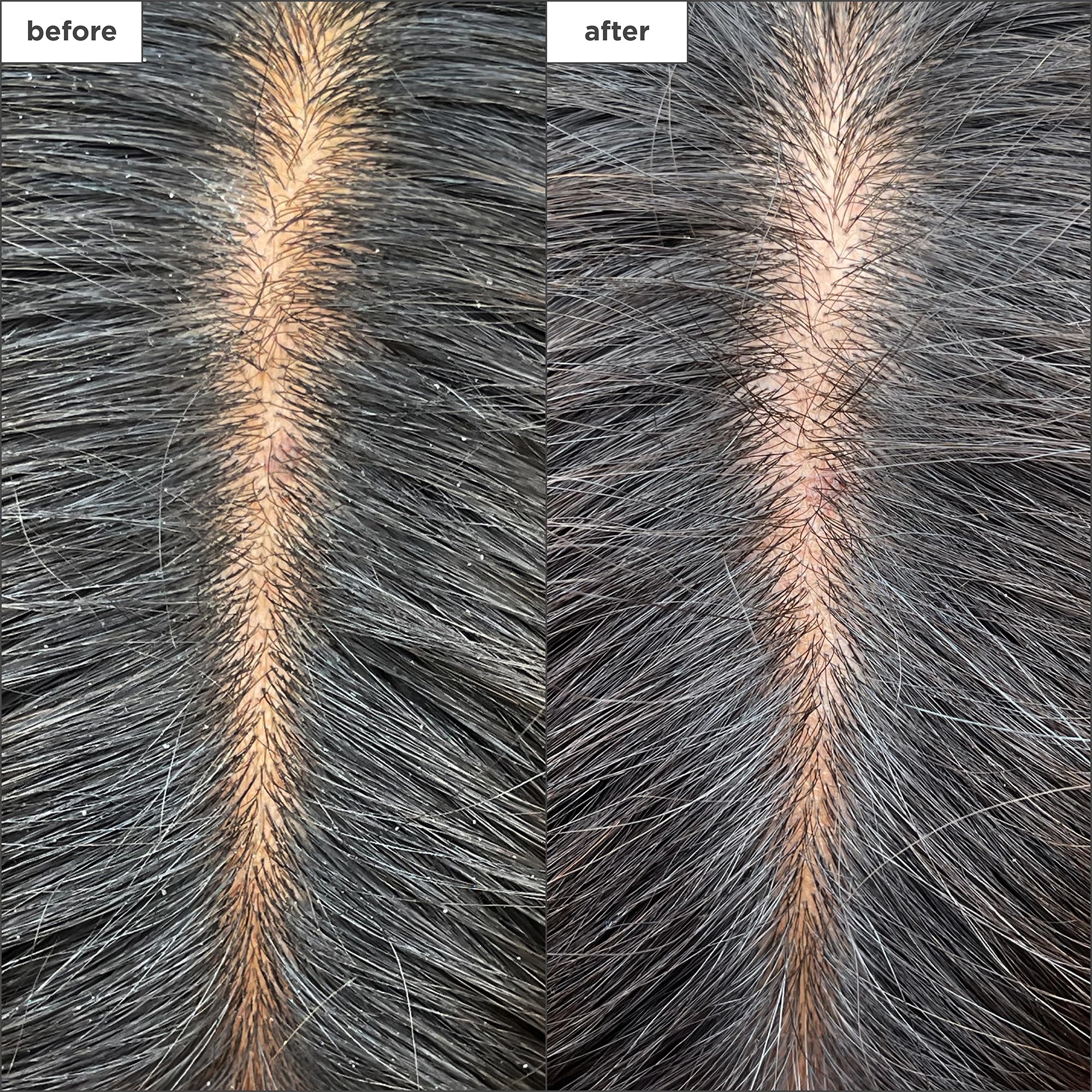 Briogeo charcoal detox visual showing impurity removal and detox.