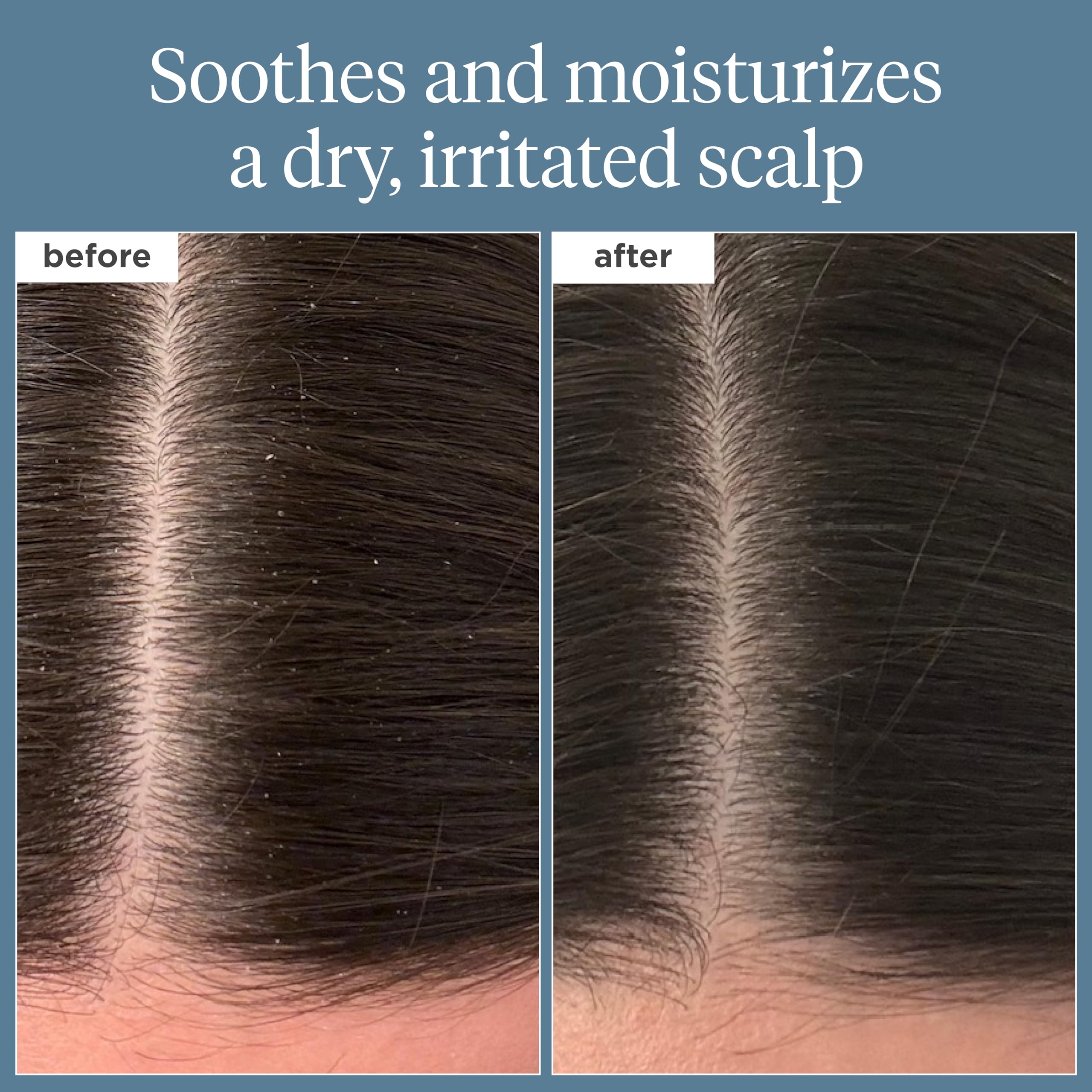 Briogeo Scalp Revival ingredients close-up highlighting nourishing botanicals