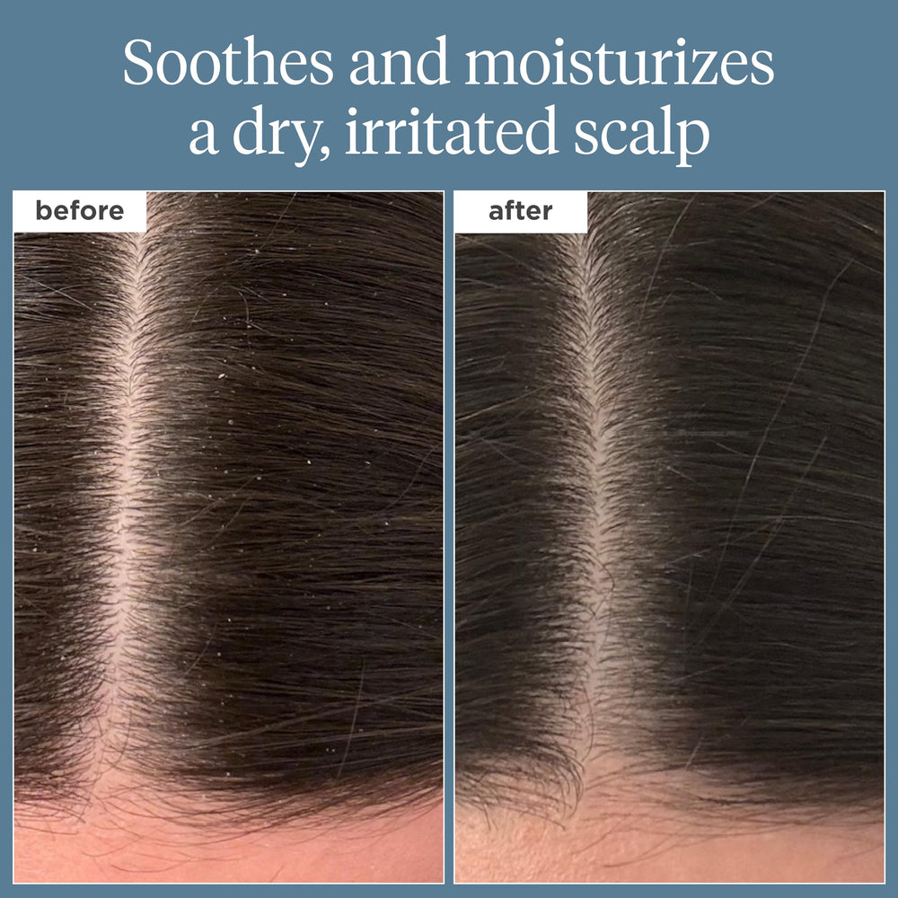 Briogeo Scalp Revival ingredients close-up highlighting nourishing botanicals