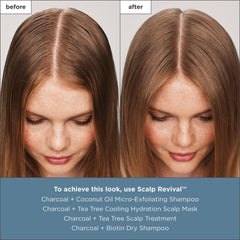 Tea tree oil in the formula provides cooling scalp relief.