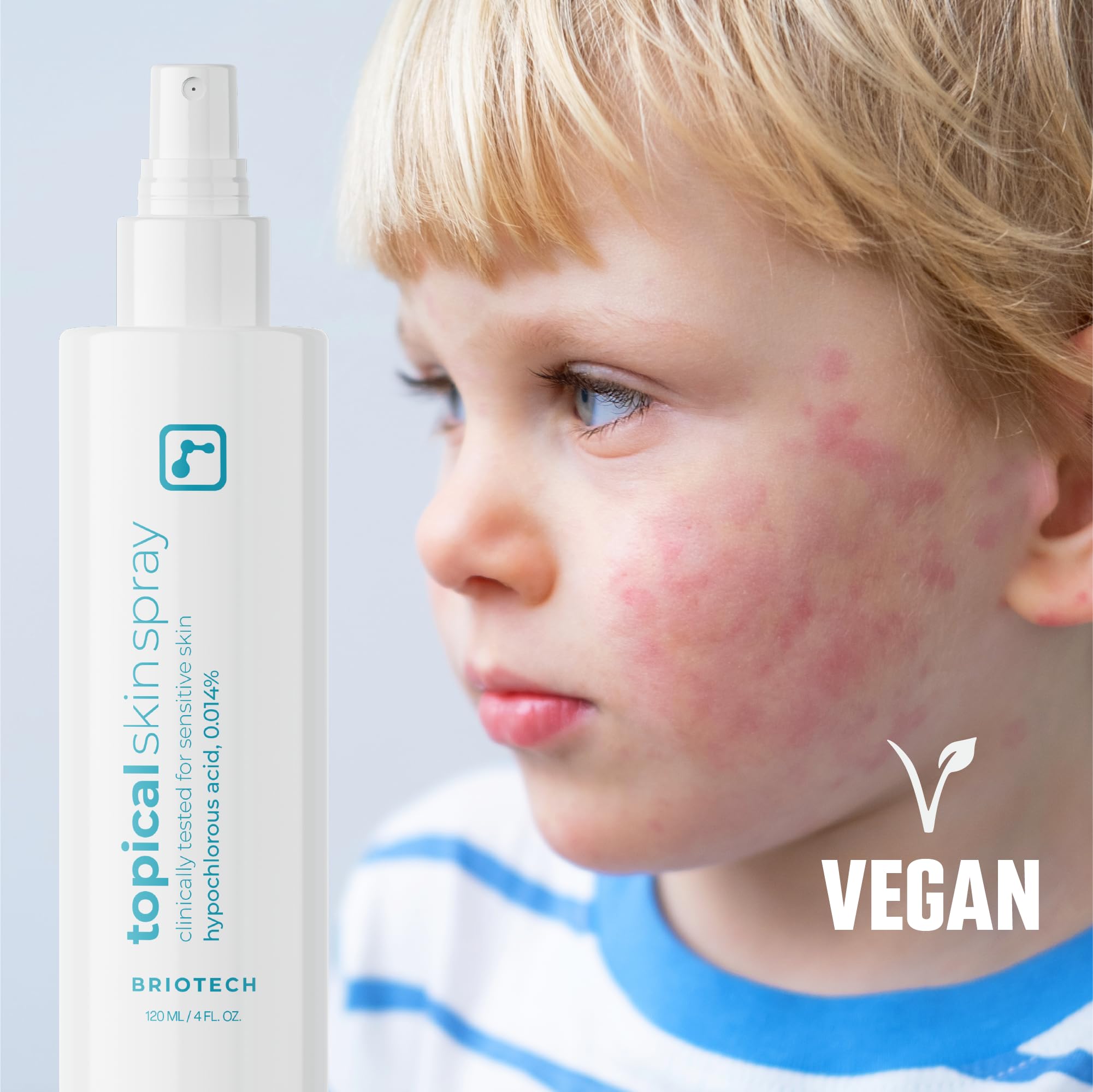 BRIOTECH Topical Skin Spray for face and body use, everyday irritation relief idea.