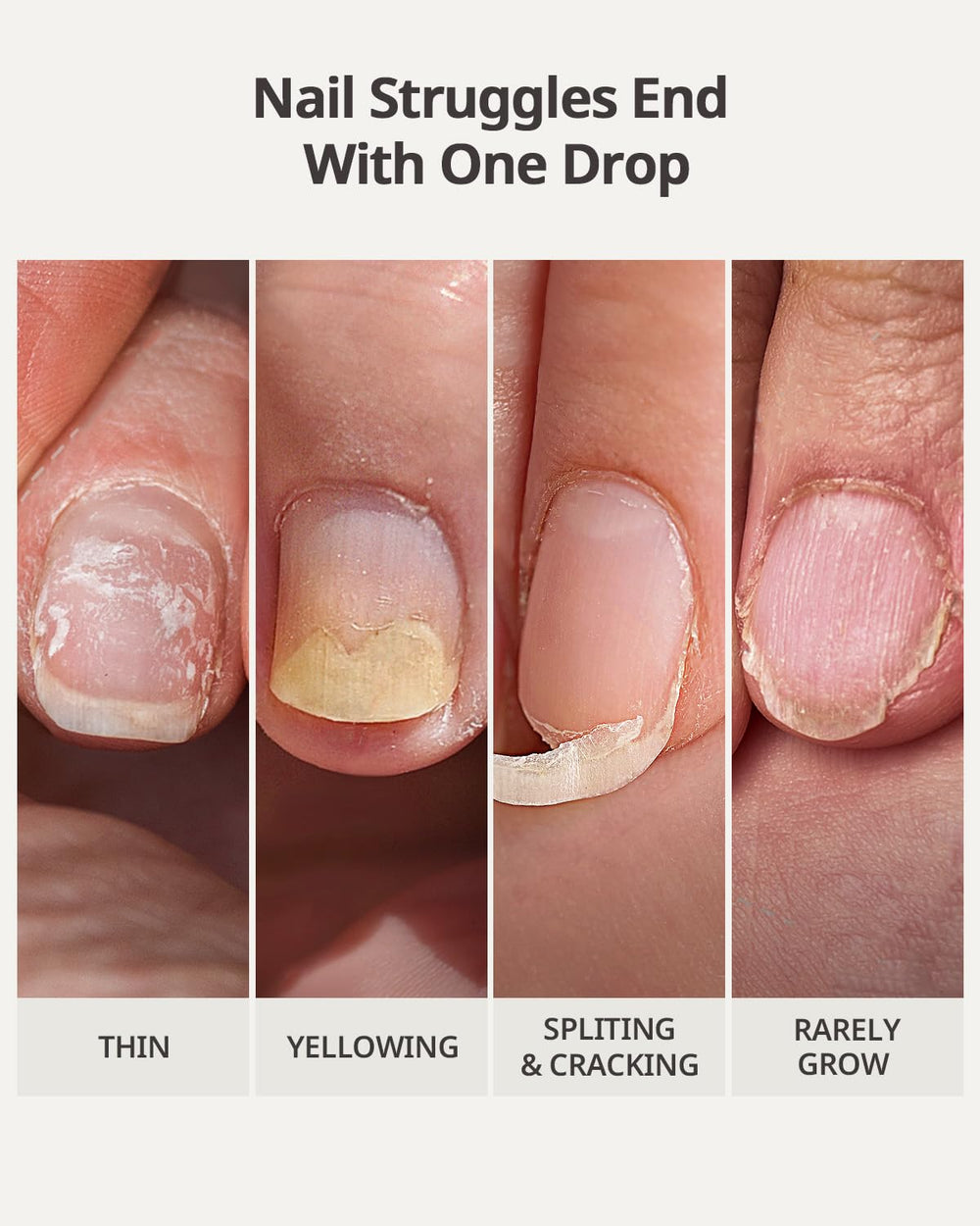 BTArtboxNails Naillush nails before and after repair comparison