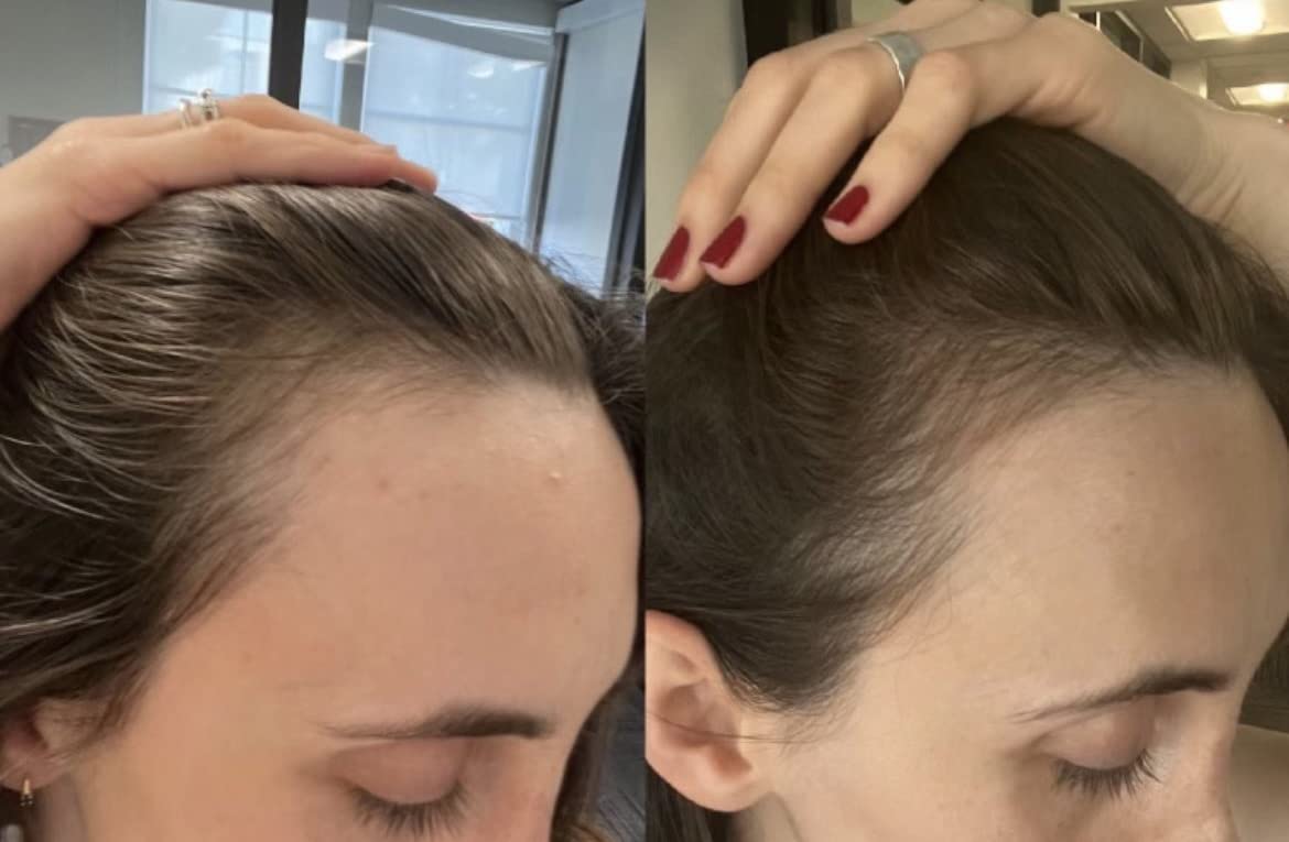 Bur Bur Growing Season Oil on hair strands after application.