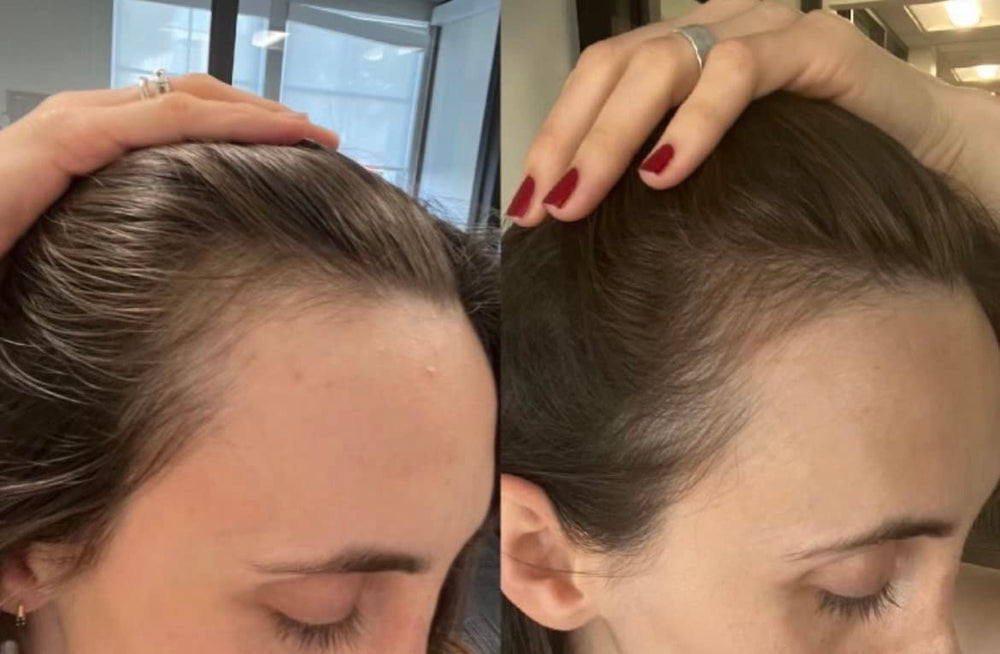Bur Bur Growing Season Oil on hair strands after application.