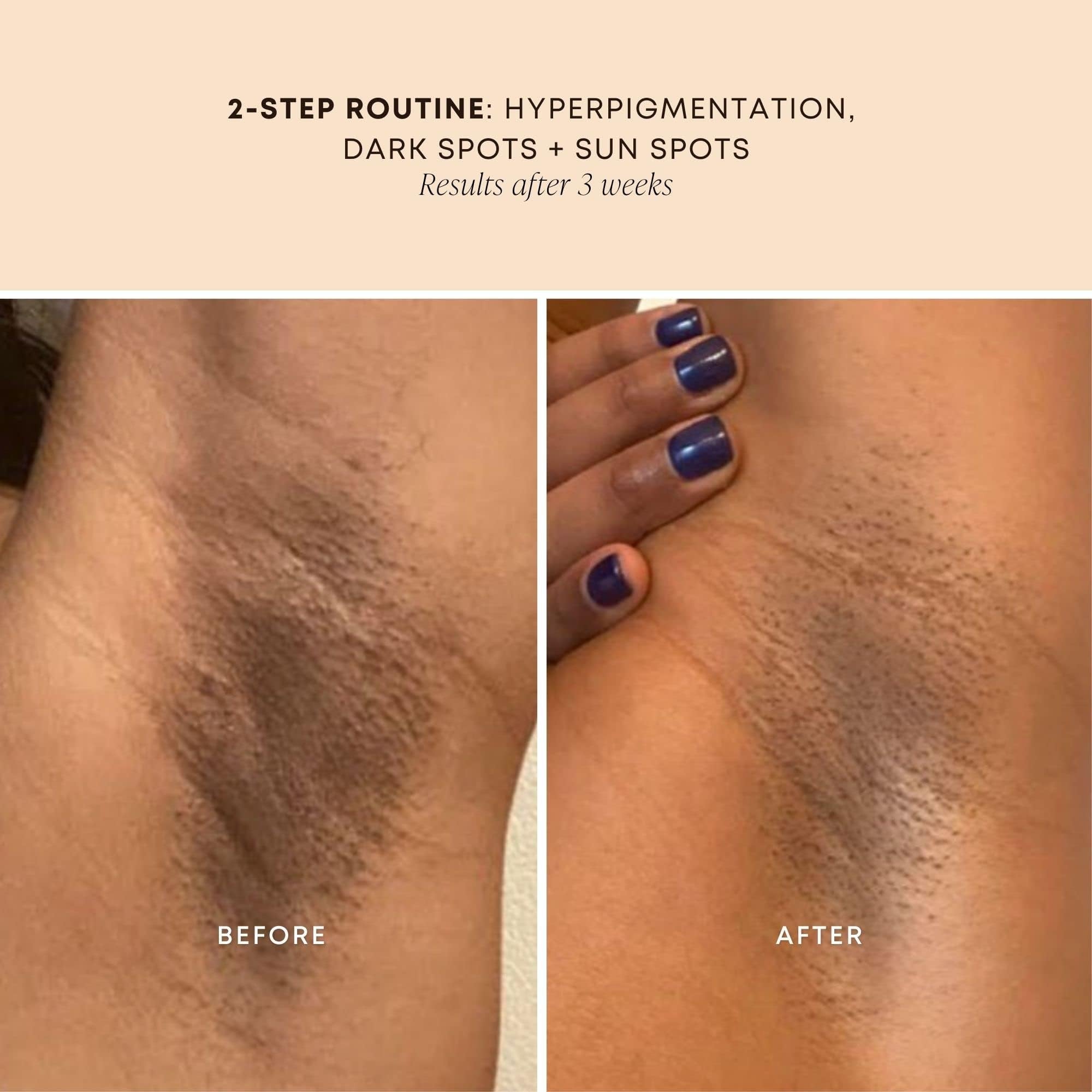 Bushbalm Bermuda Oil on bikini line showing gentle soothing routine.