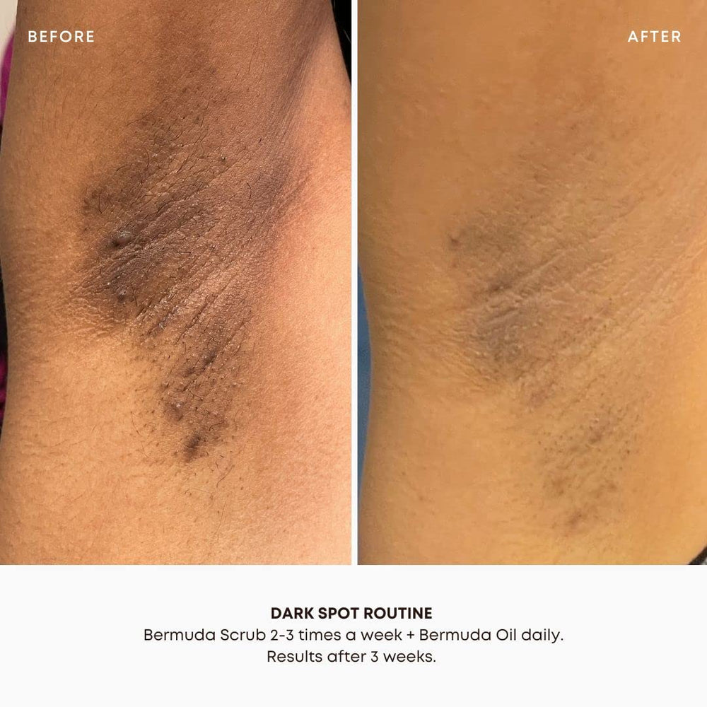 Bushbalm Bermuda scrub exfoliation action—gentle resurfacing for renewed texture.
