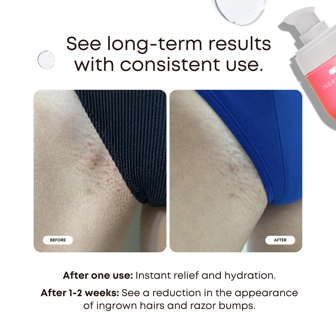 Closeup of Bushbalm Ingrown Hair Oil label showing natural ingredients.