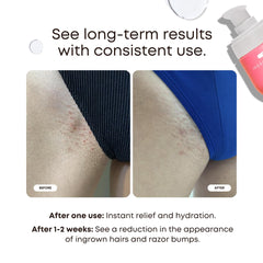 Closeup of Bushbalm Ingrown Hair Oil label showing natural ingredients.