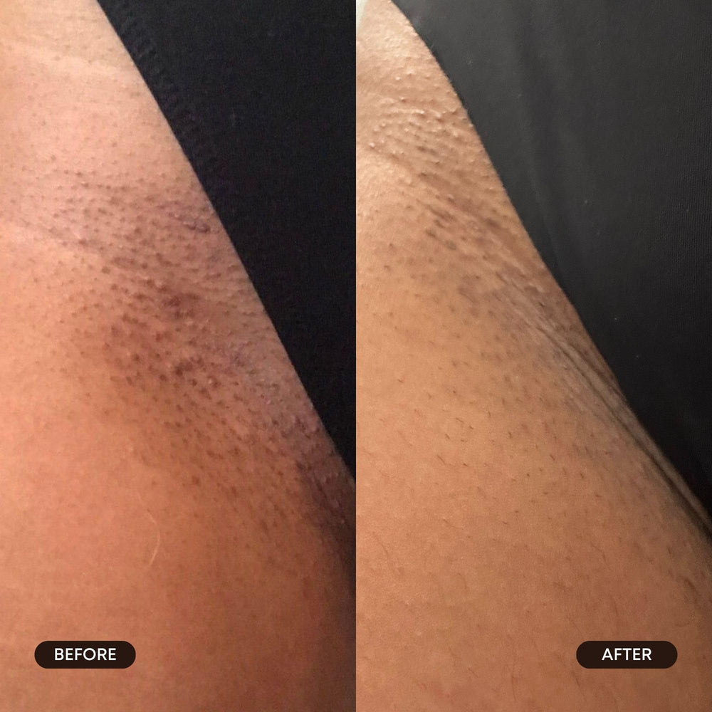Bushbalm niacinamide inclusion for hydration and glow during exfoliation.