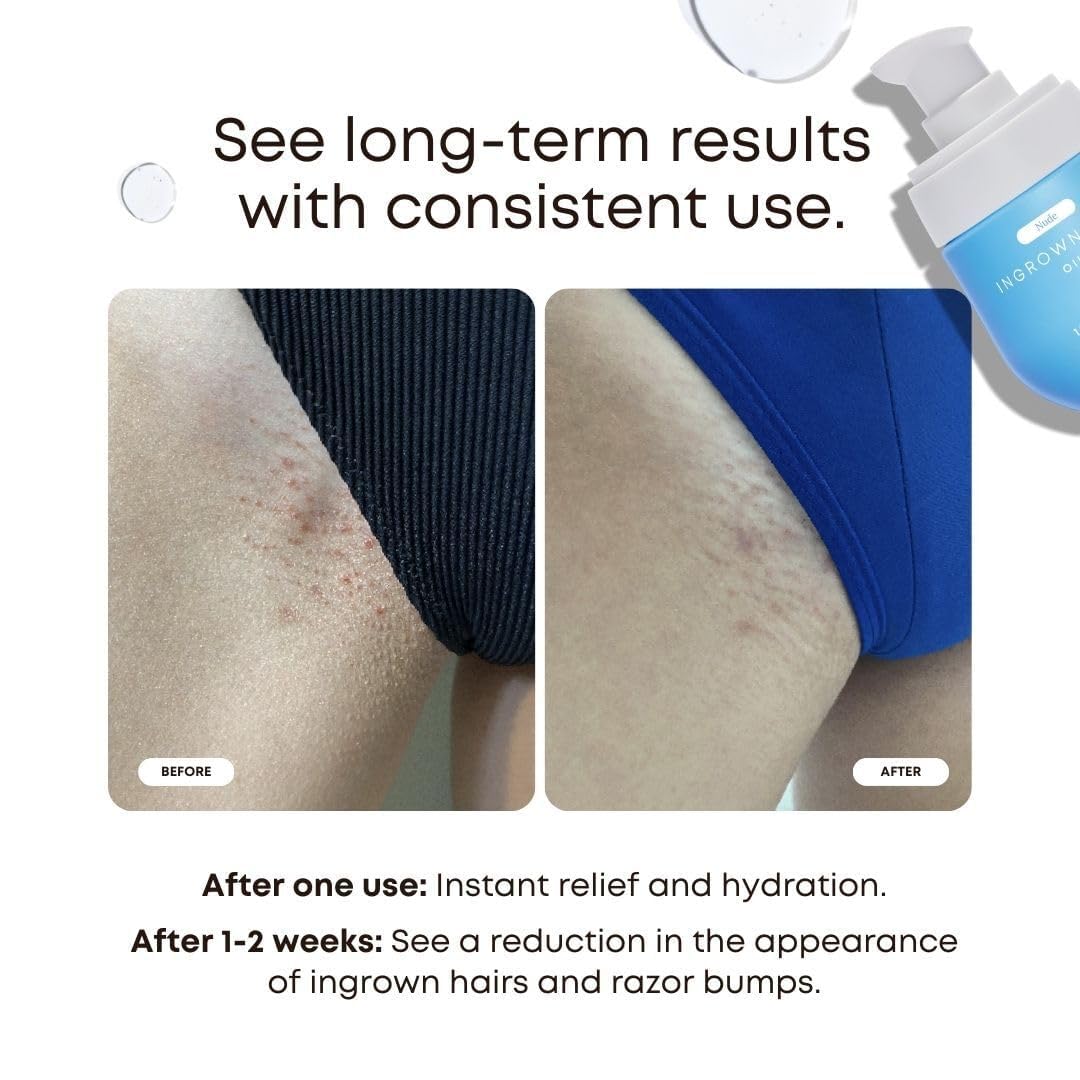 Bushbalm Nude Oil dropper applying oil to skin to reduce irritation.