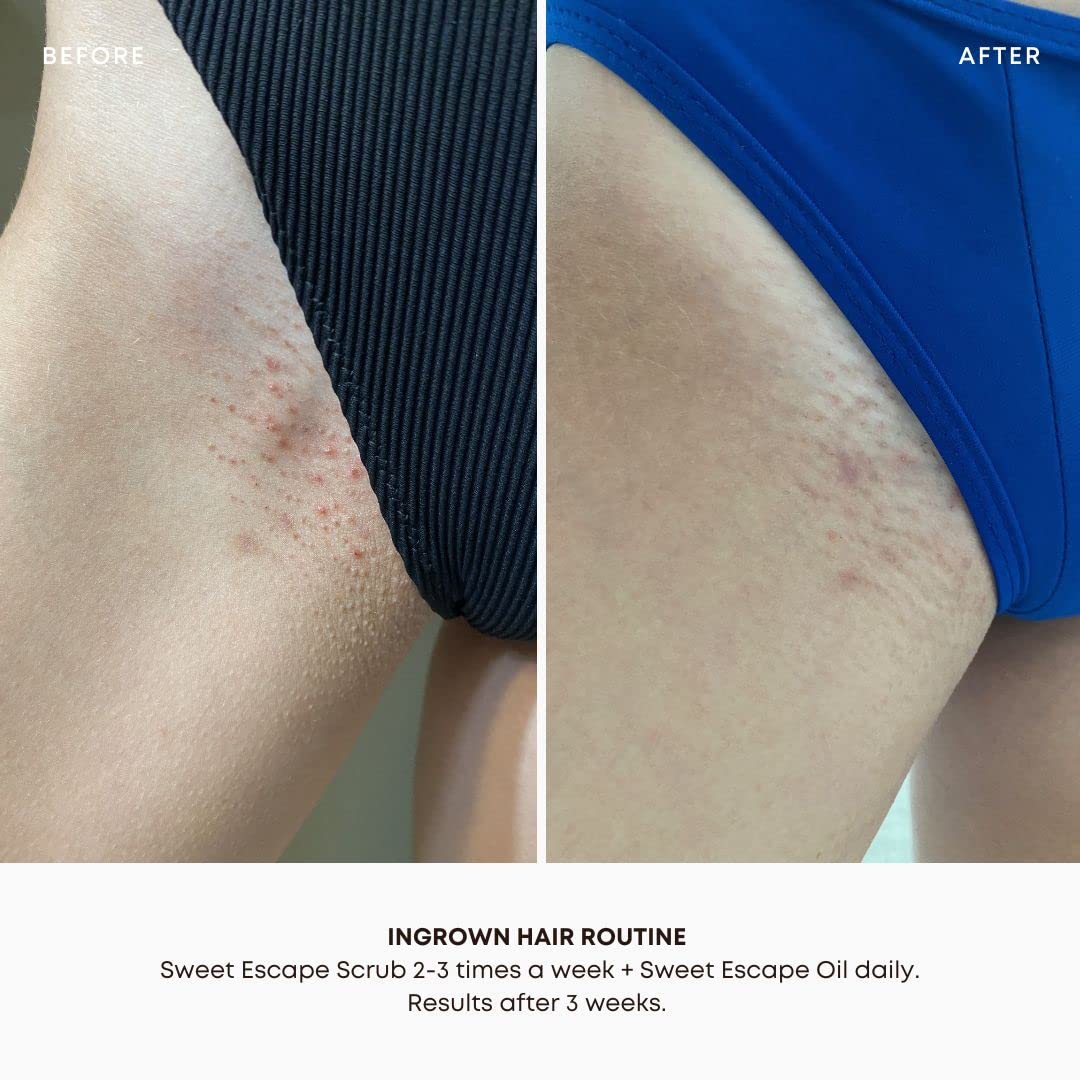 Oil close-up emphasizing jojoba and grapeseed as nourishing hydrators for dry patches.