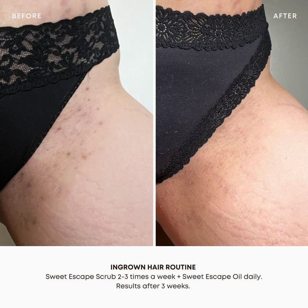 After-shave routine application demonstrated with gentle massage to calm redness.