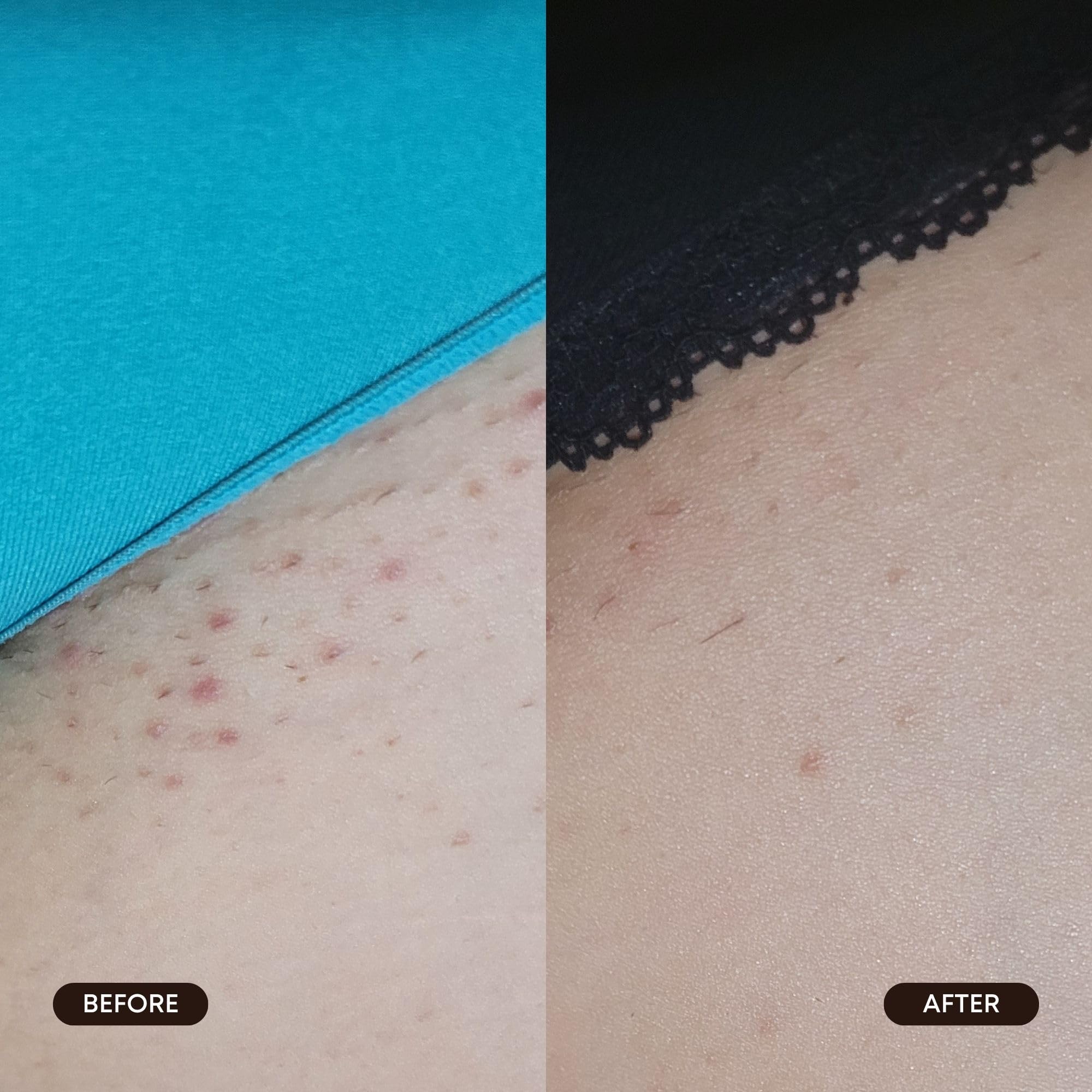 Bushbalm TXA and AHA actives shown for brighter skin and dark spots.