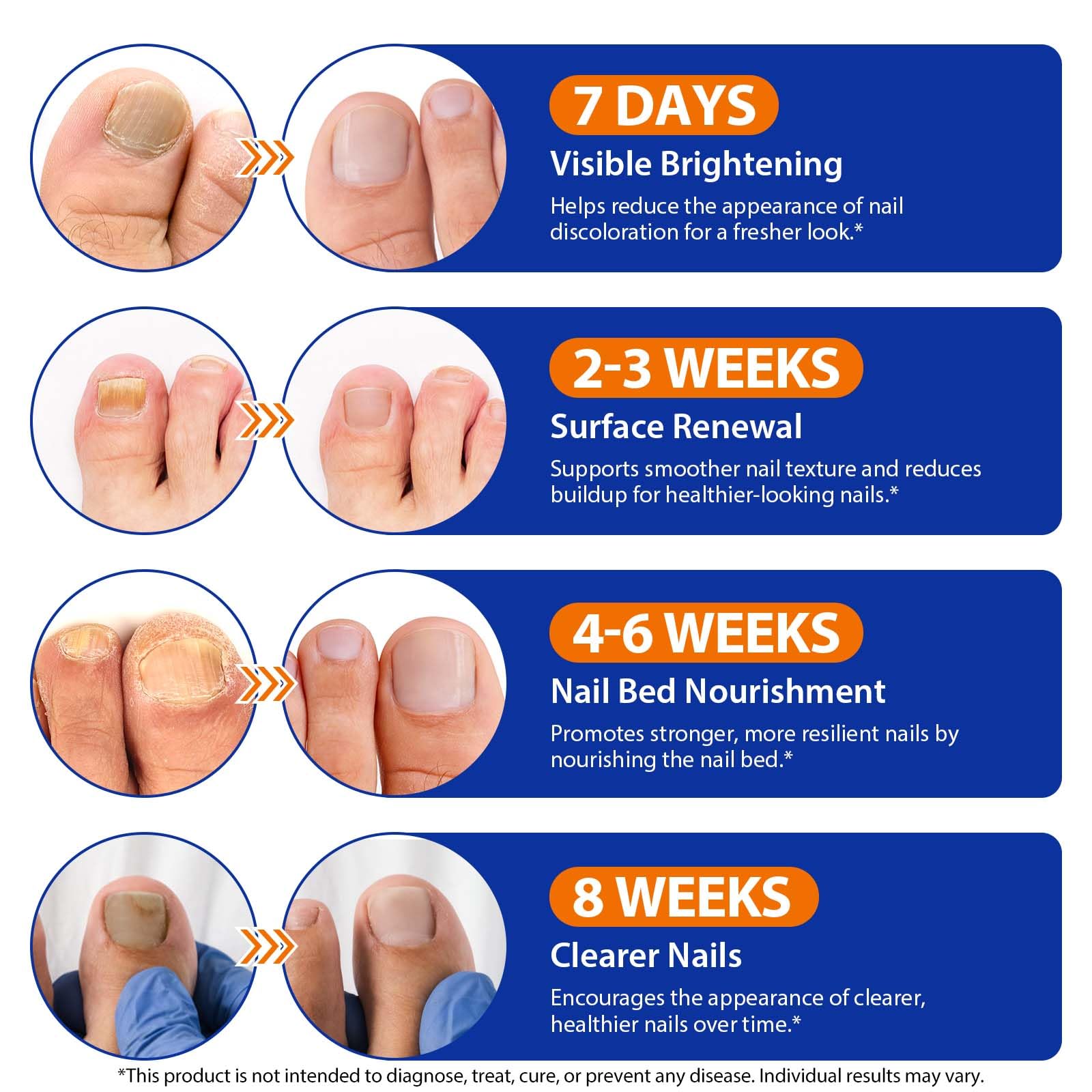 Easy-to-apply toenail patches simplify daily nail care routine.