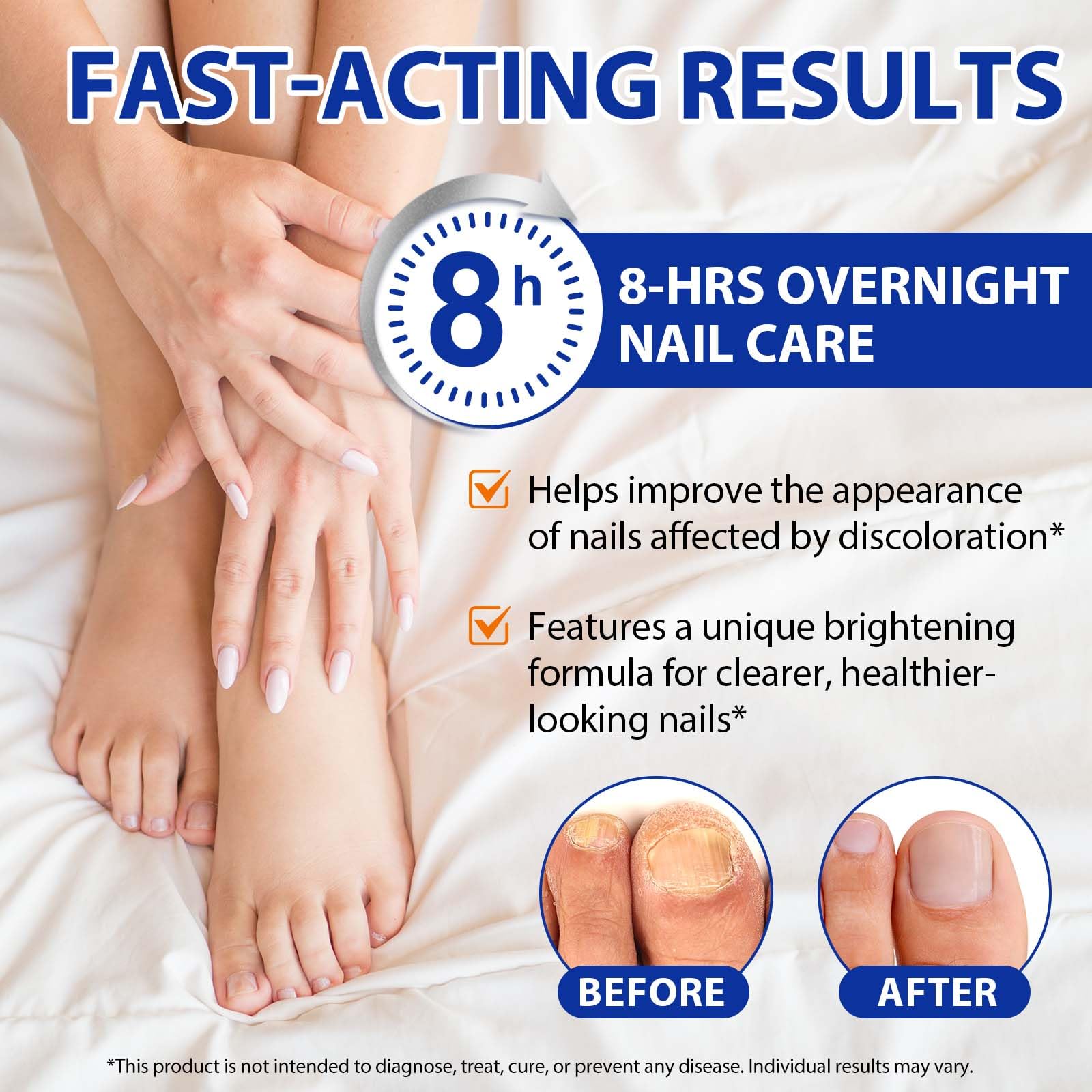 Buyourtaste extra-strength toenail treatment provides long-lasting hydration and color restoration.