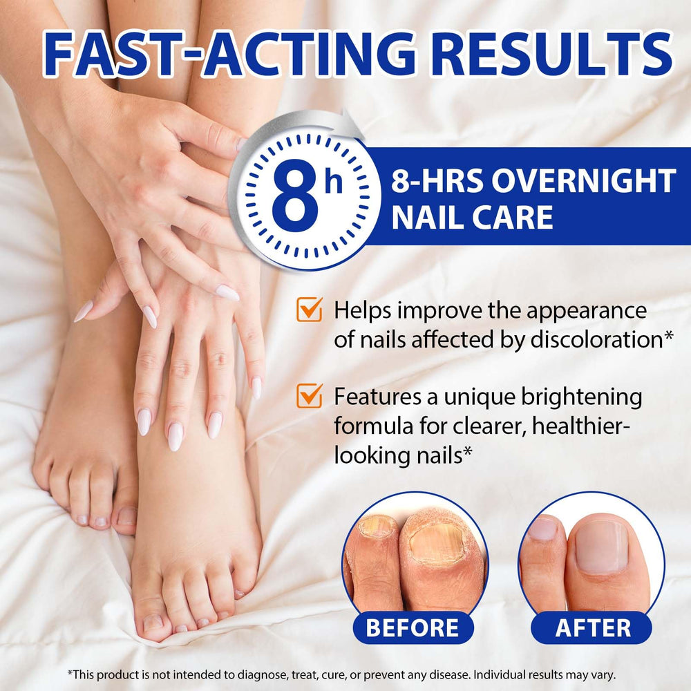 Buyourtaste extra-strength toenail treatment provides long-lasting hydration and color restoration.