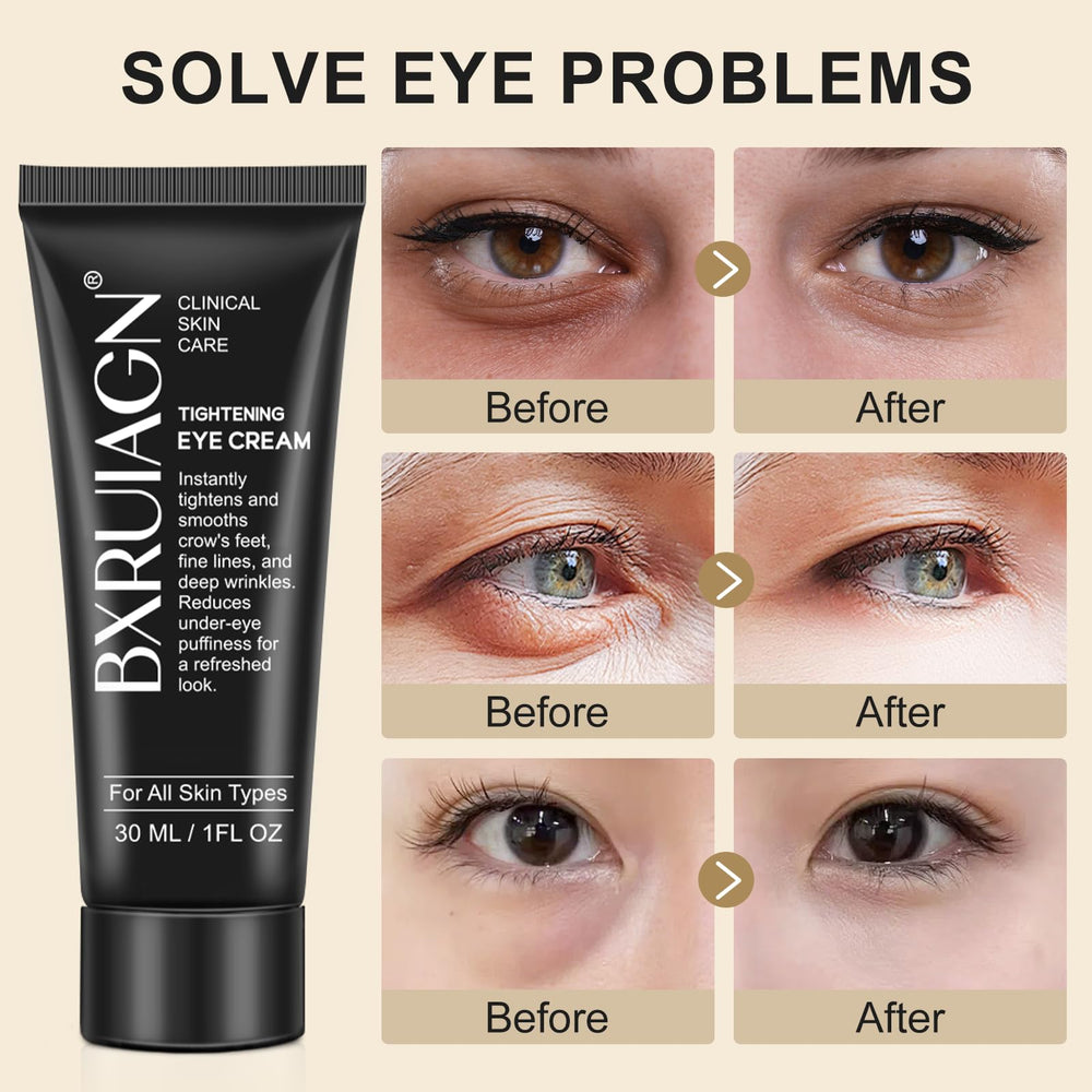 BXRUIAGN Under-eye area before-after image showing brighter, tighter-looking skin.