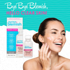 Bye Bye Blemish acne drying lotion close-up highlighting pink-tinted formula and potent acne-fighting ingredients