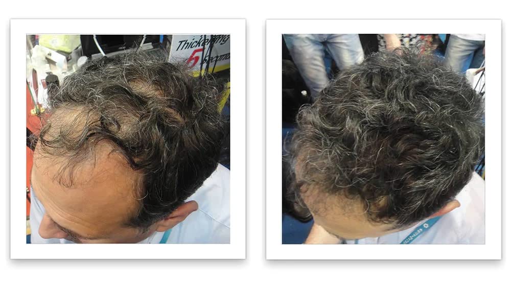 Caboki application shake-pat method demonstrates quick, mess-free use