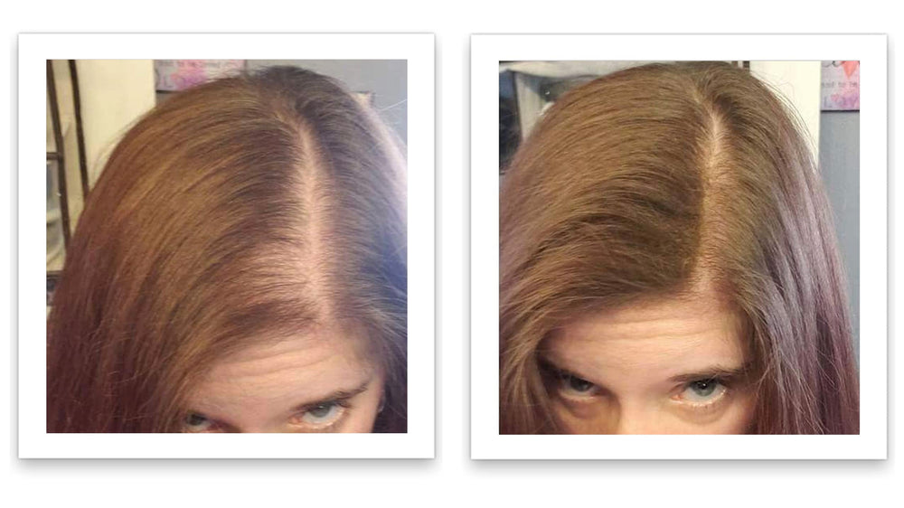 Caboki color-matched fibers blend with hair for seamless density.