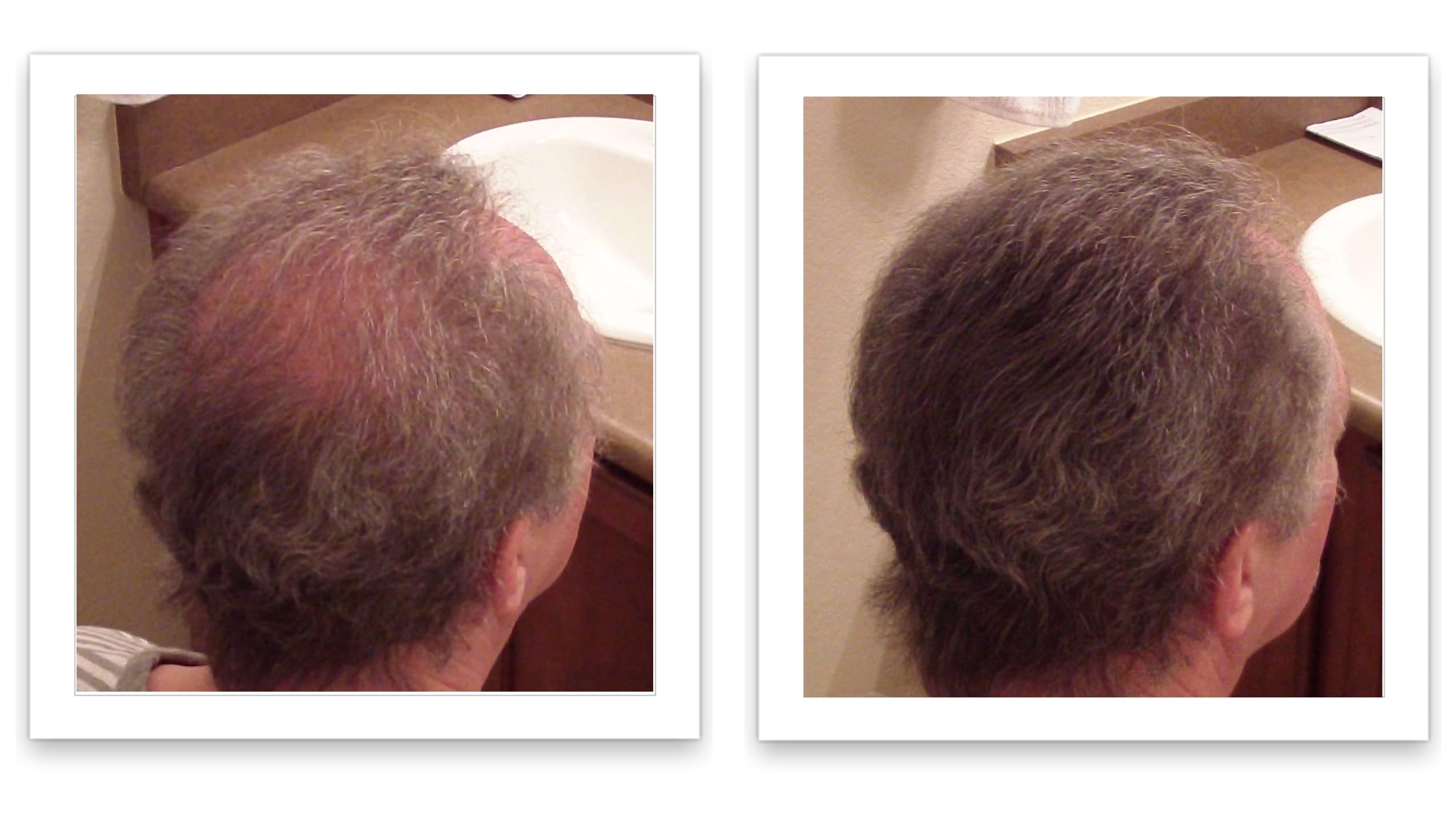 Caboki easy shake and apply method for quick use.