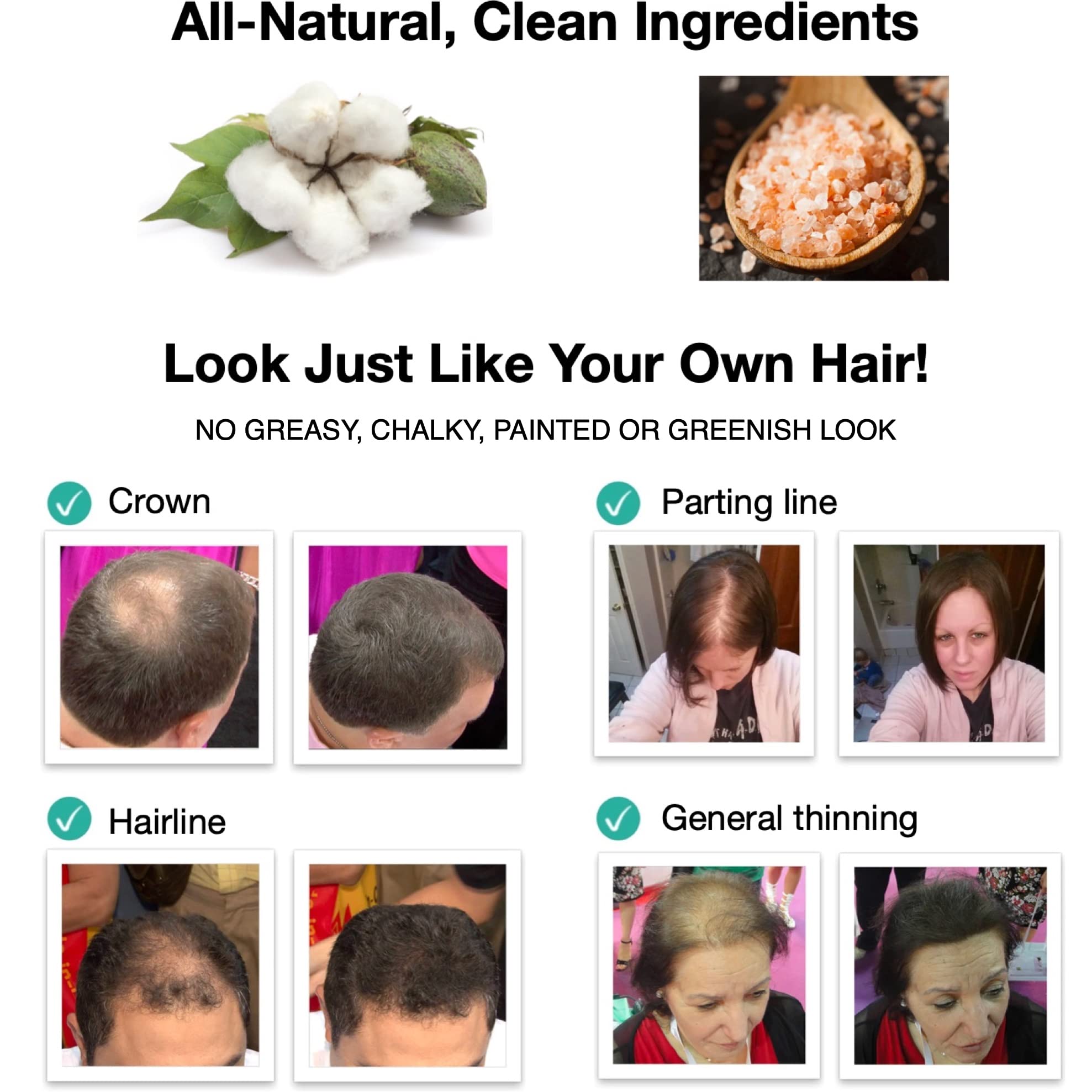 Caboki application on a thin hairline demonstrates instant look of fuller hair.