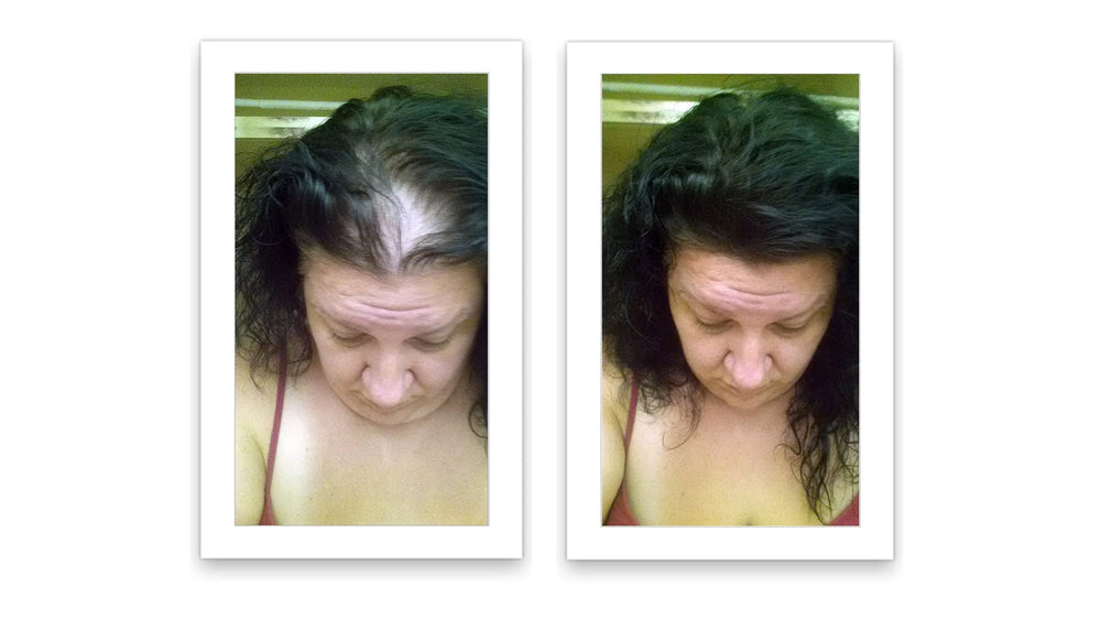 Caboki natural black color match application demonstrates seamless concealment for darker hair.
