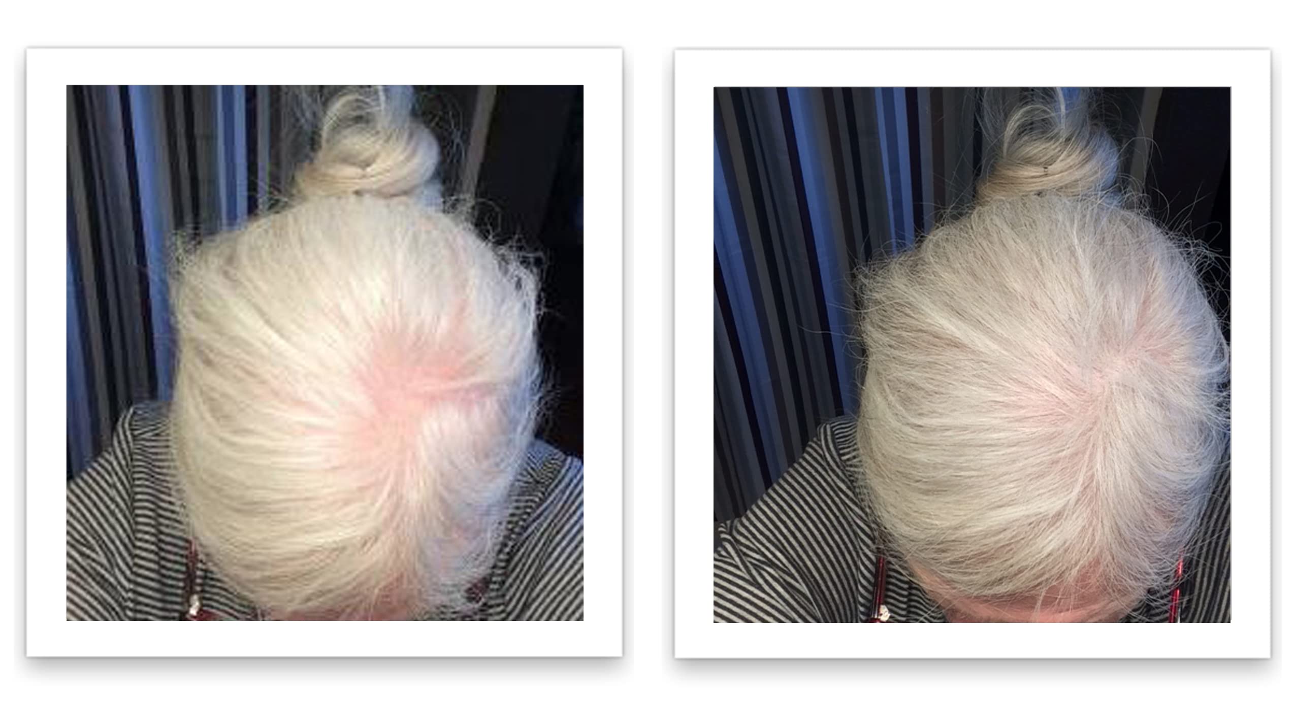 Caboki plant-based fiber natural depiction emphasizes Levant cotton fibers.