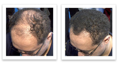 Caboki thinning hair part fullness appearance captures widened part instantly.