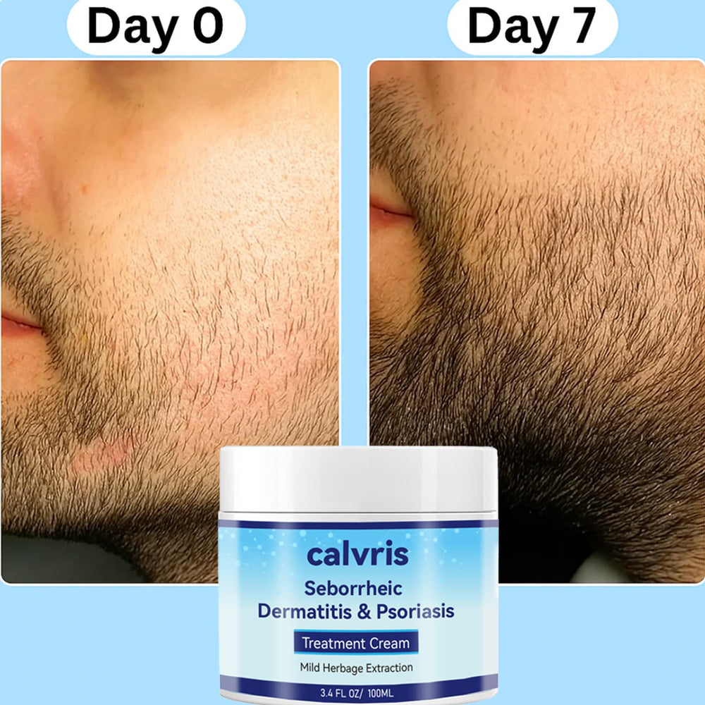 Calvris Scalp Comfort Balm texture closeup highlights lightweight, non-greasy feel.