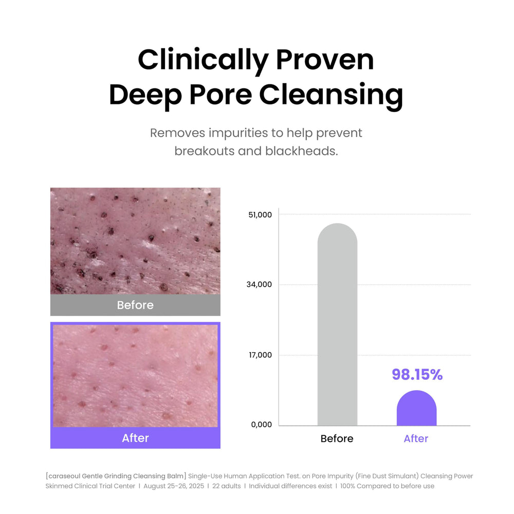 Caraseoul non-comedogenic vegan formula cleanses without clogging pores.