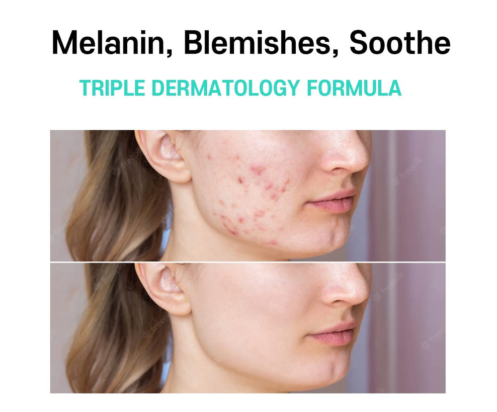 CARE:NEL Barrier-boosting formula image implies stronger skin resilience.