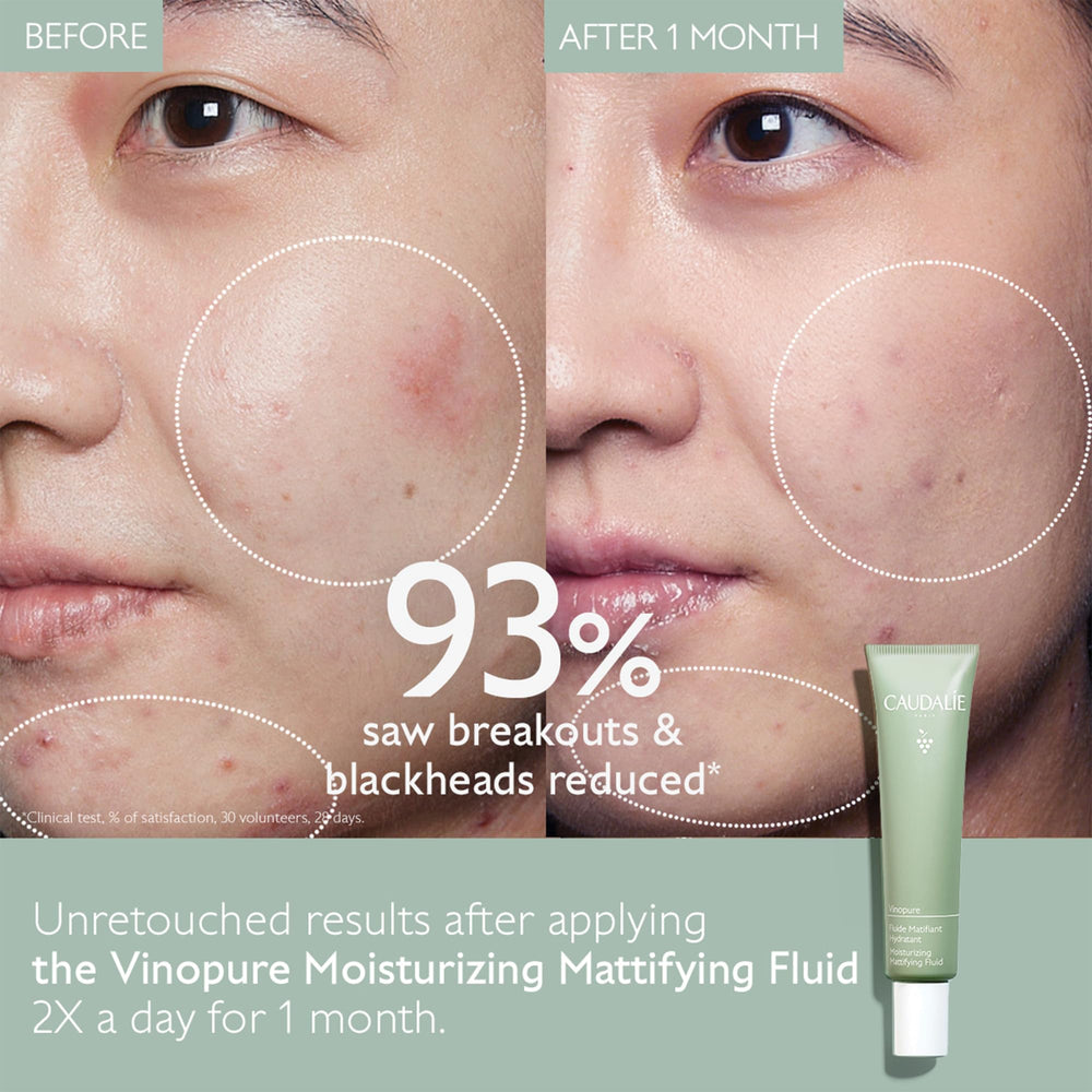 Caudalie Vinopure texture closeup—gel formula with a lightweight matte finish