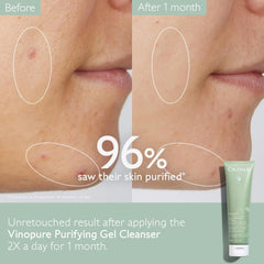 Caudalie Vinopure cleanser applied to damp skin before rinsing.