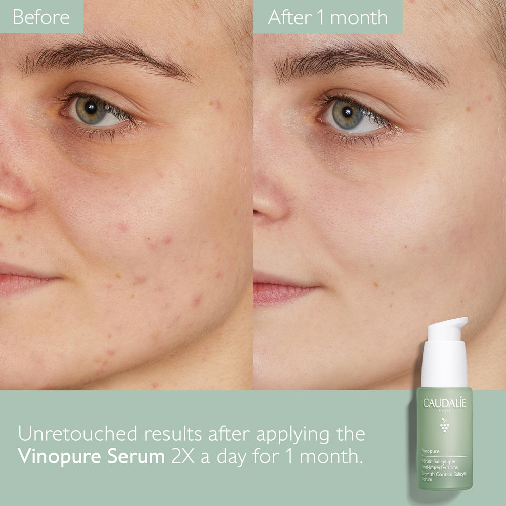 Caudalie Vinopure ingredients panel featuring salicylic acid and niacinamide.