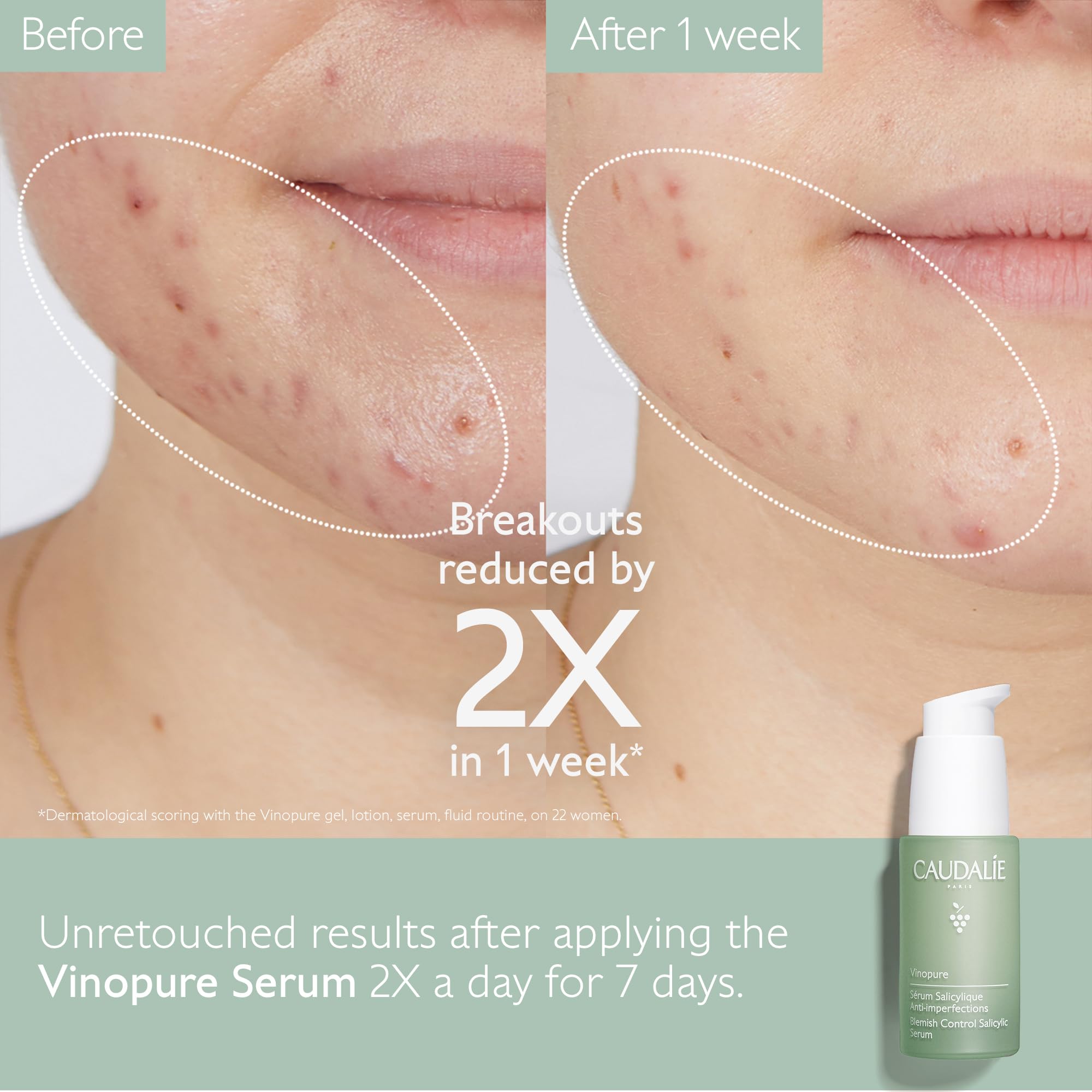 Caudalie Vinopure serum massage on skin for smoother texture.
