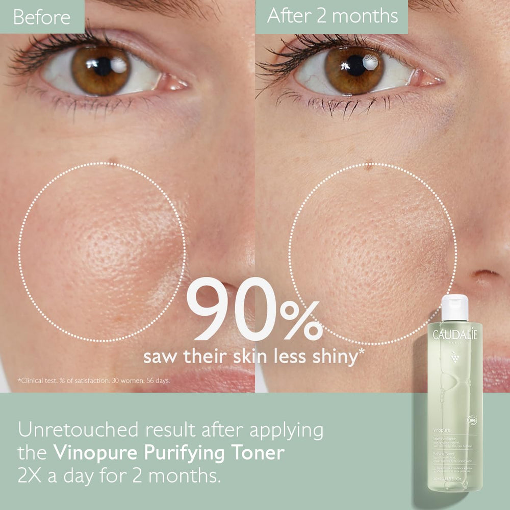 Caudalie Vinopure toner on cotton pad for cleansing and mattifying use.